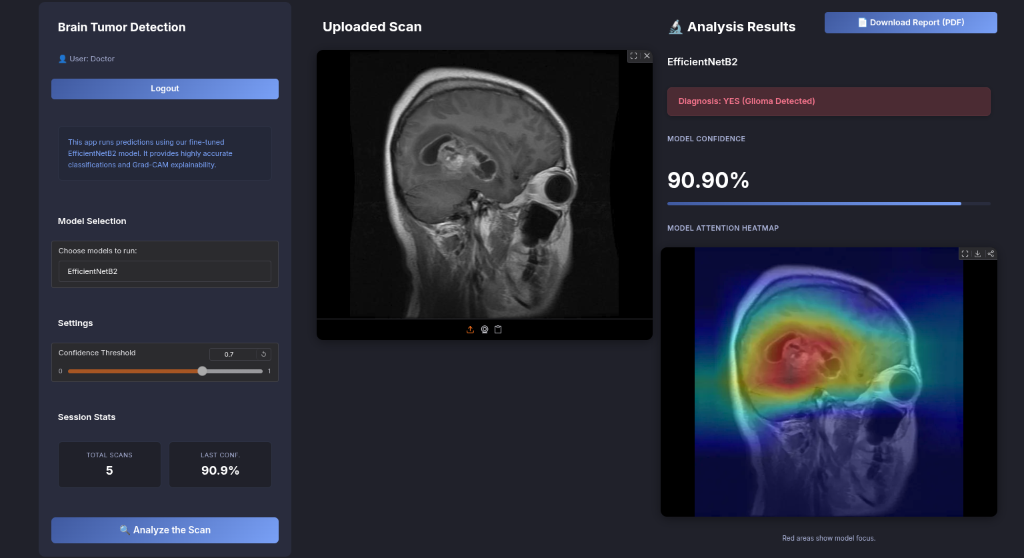 MRI Brain Tumor Detection & Classification